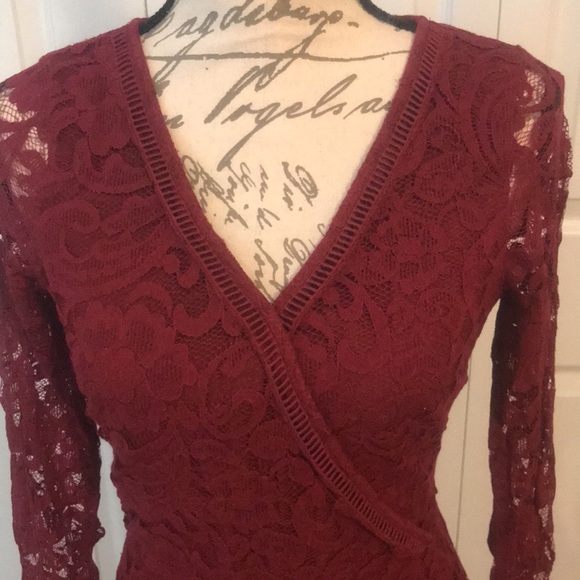 Hollister V-neck Lace Dress - Picture 2 of 10